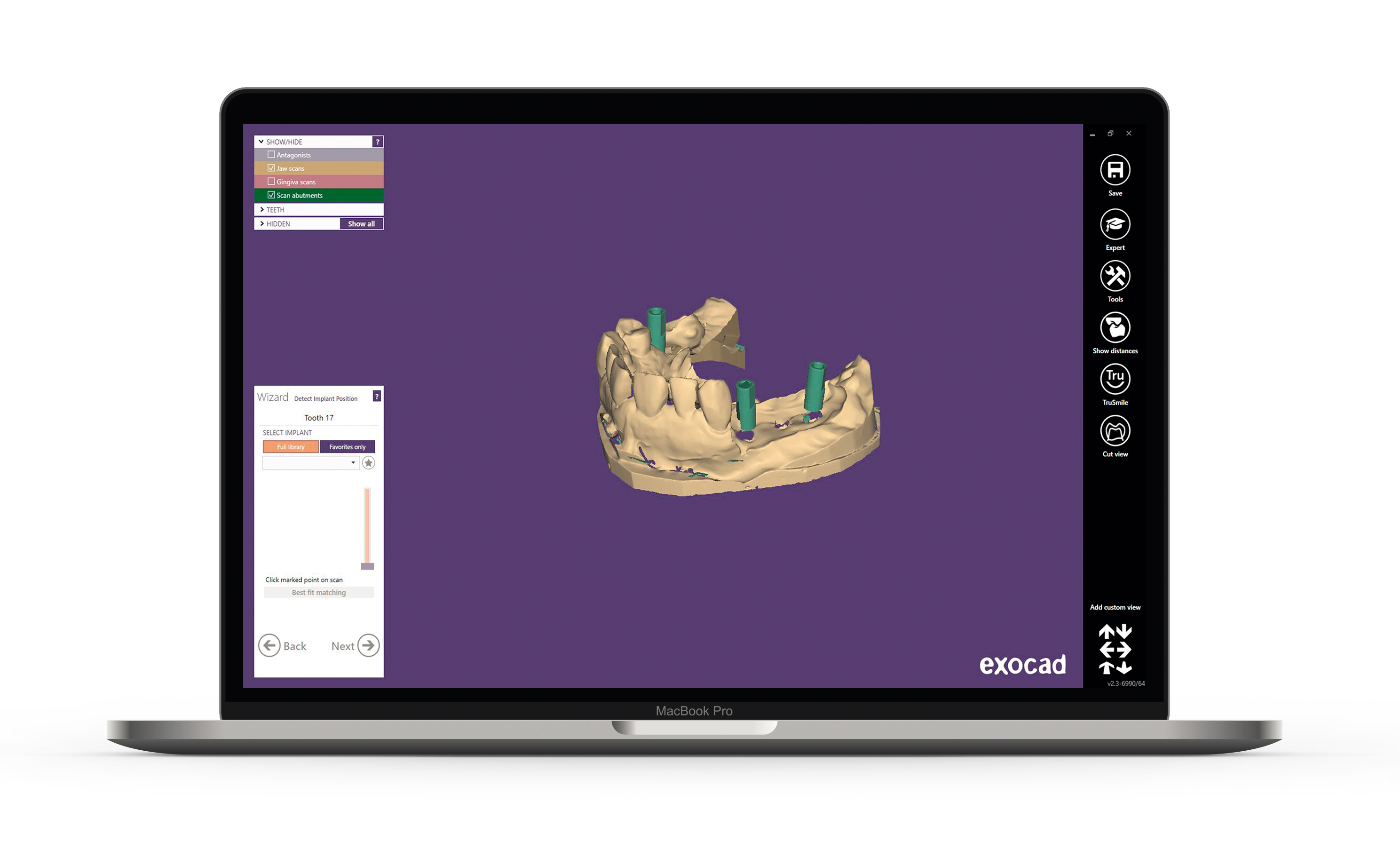 <h3>CAD CAM</h3>
<p>In collaboration with the main developers of dental design software, we have developed a digital library for our IBO products which works with a wide range of possibilities for CAD/CAM.</p>